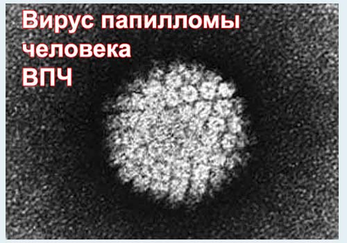 фото ВПЧ-вируса под электронным микроскопом