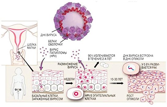 Схема развития вируса папилломы человека